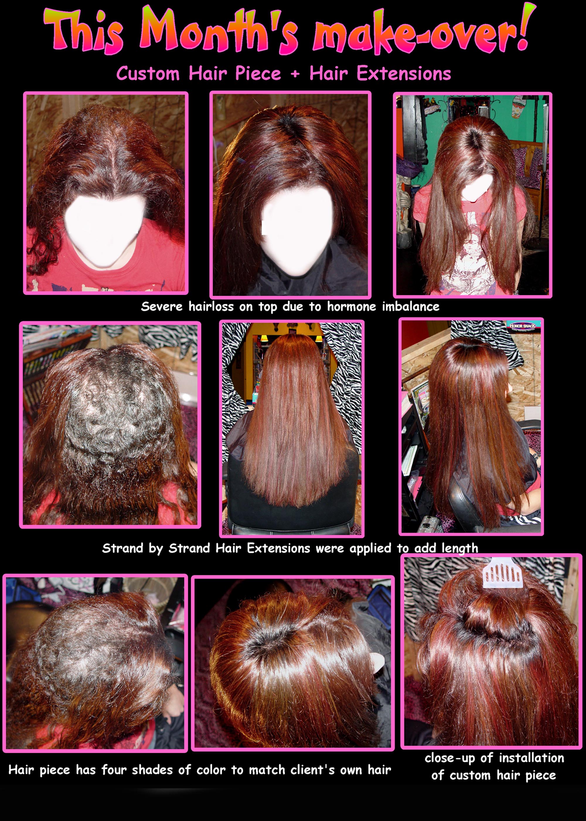 This client suffers from severe hairloss on the top area due to a hormone imbalance. The new customized mesh hair piece was a perfect choice for covering her problem area.